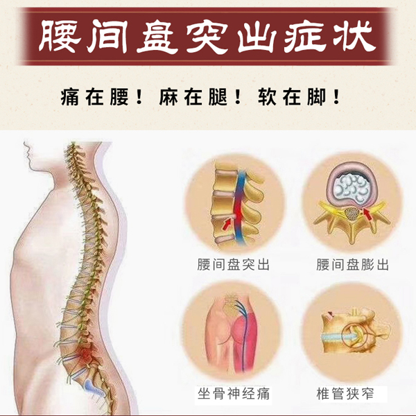 腰椎间盘突出压迫神经怎么治？腰椎间盘突出的原因？