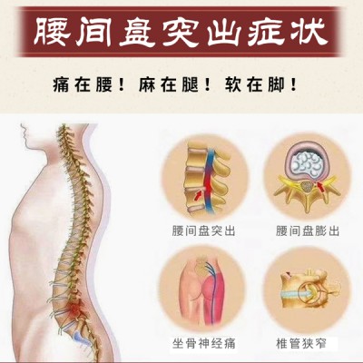 腰椎间盘突出压迫神经怎么治？腰椎间盘突出的原因？