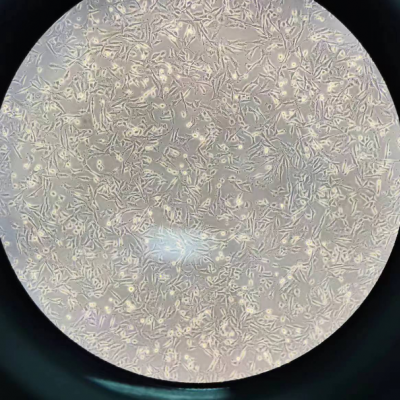 MDA-kb2（人乳腺癌细胞）（DMEM）STR鉴定正确