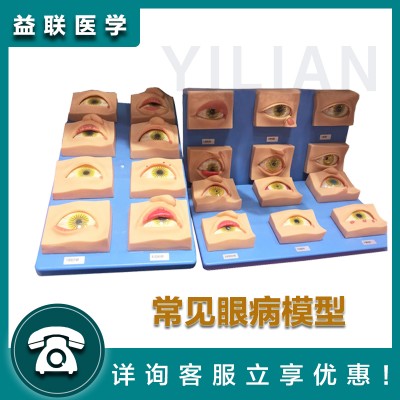 益联医学常见眼病模型