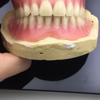 深圳定制式牙齿隐形正畸矫治器-3D隐形矫正-隐形牙套矫治工厂